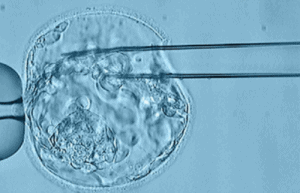 Imagen de Biopsia Embrionaria
