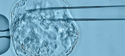 Imagen de Biopsia Embrionaria