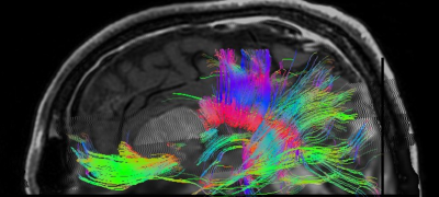 Curso Neuroimagen Avanzada y Biomarcadores