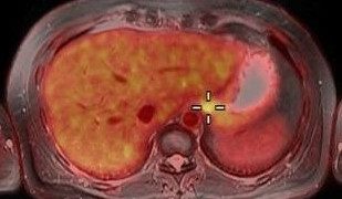 Curso Operador de Instalaciones Radiactivas en Medicina Nuclear (CSN)